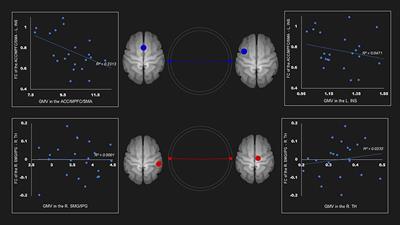 Functional and Structural Alteration of Default Mode, Executive Control, and Salience Networks in Alcohol Use Disorder